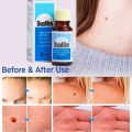 Wart Remover Doufilm Lotion 15ml. 