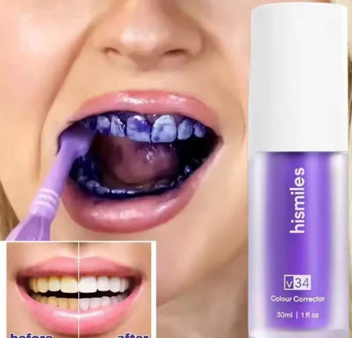 HiSmile Kit Purple Whitening Toothpaste – Instant Brightening Formula 30 ml