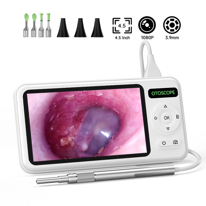 4.5 Inch Digital Otoscope HD1080P 3.9mm Ear Picker Ear Camera 6 LEDs ...