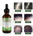 ALIVER Rosemary Essential Oil for Hair Growth, Enhanced Shine, 100% Pure Natural, Nourishment Scalp, Improves Blood Circulation, Best Serum for Skin, 2 fl oz. 