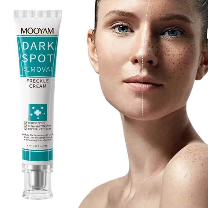 MOOYAM%20Dark%20Spot%20Removal%20Freckle%20Cream%2030g%20-%20Image%202