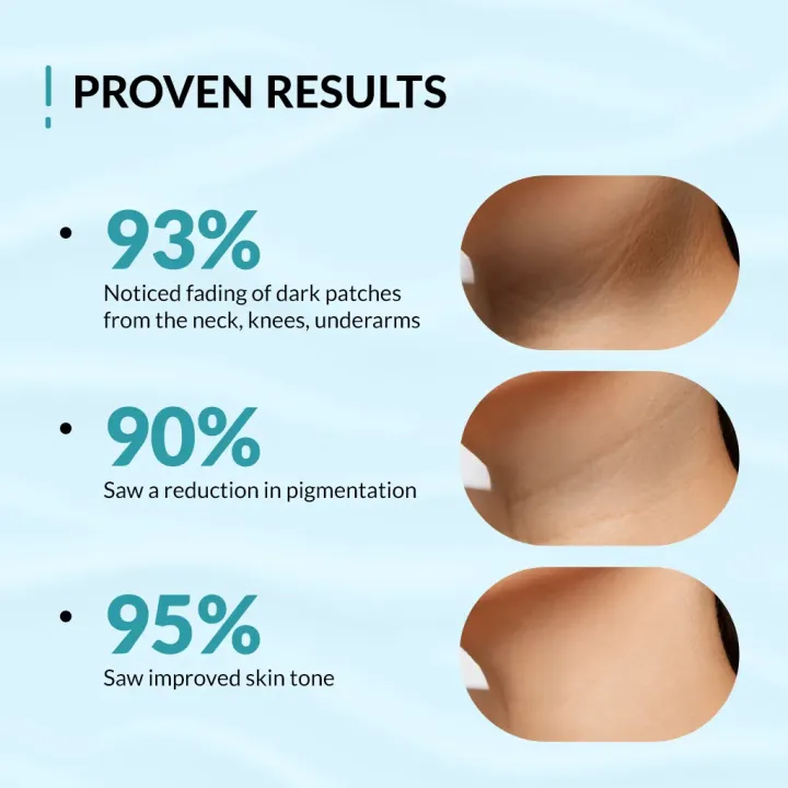 Fix%20Derma%20Nigrifix%20Cream%20100%20gm%20%7C%20Reduces%20Dark%20Elbows,%20Knees,%20Underarms%20&%20Neck%20-%20Image%206