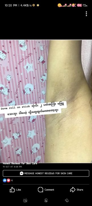 Dove%20Ultimate%20Repair%20Darkmarks%20Corrector%20Roll%20On%20Stick%20%7B%20Uk%20Made%20%7D%20-%20Image%204