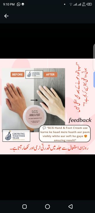 LuxeGlow%20Hand%20&%20Foot%20Cream%20%E2%80%93%20Whitening,%20Deep%20Moisturizing%20&%20Cracked%20Heel%20Repair%20for%20Soft,%20Smooth%20&%20Glowing%20Skin%20-%20Image%203