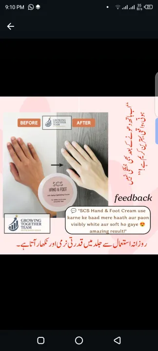 LuxeGlow%20Hand%20&%20Foot%20Cream%20%E2%80%93%20Whitening,%20Deep%20Moisturizing%20&%20Cracked%20Heel%20Repair%20for%20Soft,%20Smooth%20&%20Glowing%20Skin%20-%20Image%203