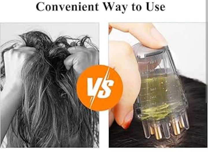 Hair%20Oil%20Applicator,%20Scalp%20Massage%20Comb%20with%20Roller%20Ball%20Portable%20Mini%20Head%20Fluid%20Brush%20for%20Liquid%20Oil%20and%20Essential%20Oil%20%20Hair%20Growth%20Care%206ml%20-%20Image%202
