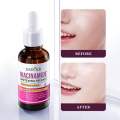 SADOER Niacinamide Skin Whitening Face Serum for Shrink Pores, Dark Spots and Freckles serum-30ml. 