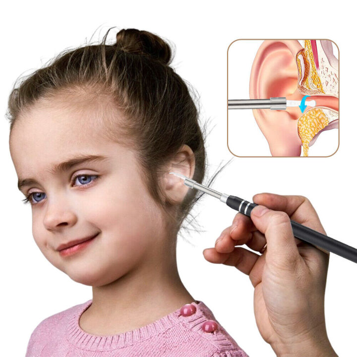 Self-service%20Ear%20Cleaning%20Endoscope%20Set%20Wireless%20Intelligent%20ear%20cleaner%20Earwax%20Remover%20HD%20Camera%20Ear%20Cleaner%20for%20the%20elderly%20-%20Image%204