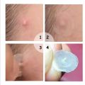 Pimple patch 120pcs pimple patch high quality effective Acne patch cover. 