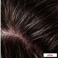 Nizoral 2% Ketoconazole Hair Care Anti-Dandruff Shampoo 100ml.