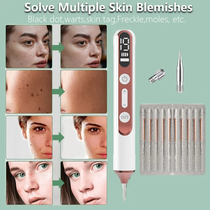 Plasma%20Pen%20Skin%20Tag%20Remover%20Mole%20Removal%20Wart%20Spots%20Dark%20Dpot%20Black%20Dot%20Nevus%20Freckle%20Flat%20Blemish%20Pimples%20Removal%20for%20Face%20Body%20-%20Image%206