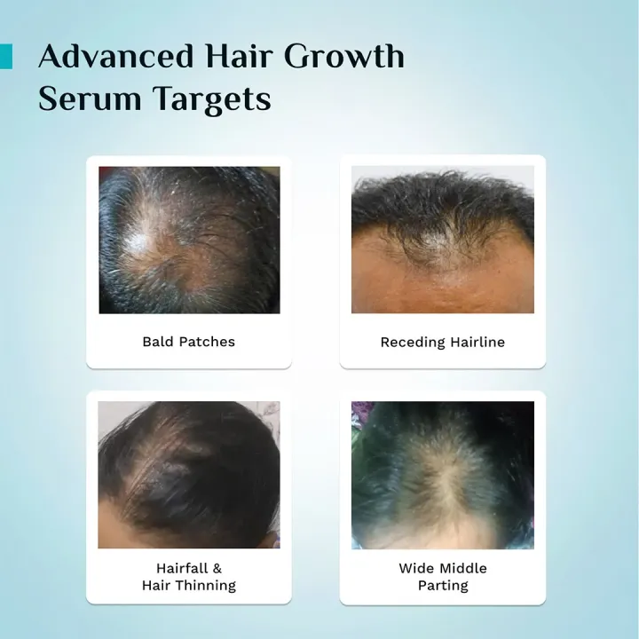 Pilgrim%203%25%20Redensyl%20+%204%25%20Anagain%20Hair%20Growth%20Serum%2030%20ml%20-%20Image%207