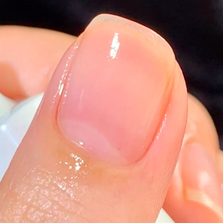 Tinovo%20Uno%20Vitamin%20E%20Cuticle%20Oil%20Nail%20Art%20Treatment%20Nourishment%20Oil%20Soften%C2%A0Moisturizing%20Nail%20Strengthener%20Repair%20Damaged%20Nails%20-%20Image%204