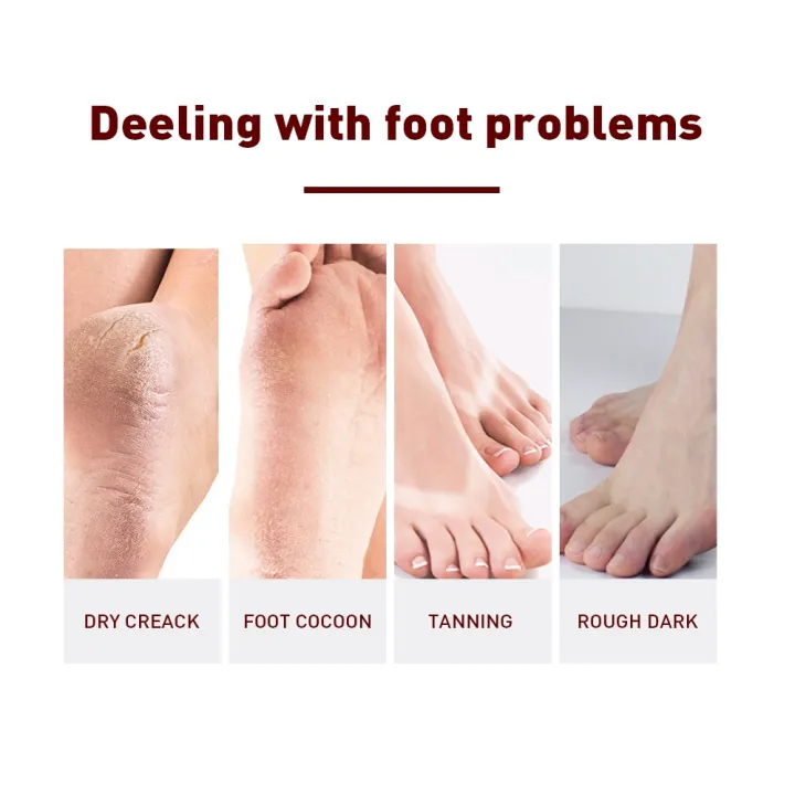 1%20Pair%20Exfoliating%20Feet%20Mask%20Exfoliating%20Foot%20Peel%20Mask%20Socks%20Pedicure%20Peeling%20Dead%20Skin%20Remover%20Feet%20Mask%20Peel%20Moisturizing%20-%20Image%204