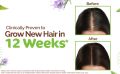 Indian Mamaearth Rosemary Hair Growth Oil | Control Hair Fall & Strengthens Weak Follicles | Scalp Care with Methi Dana for Strong Roots |  (100ml). 
