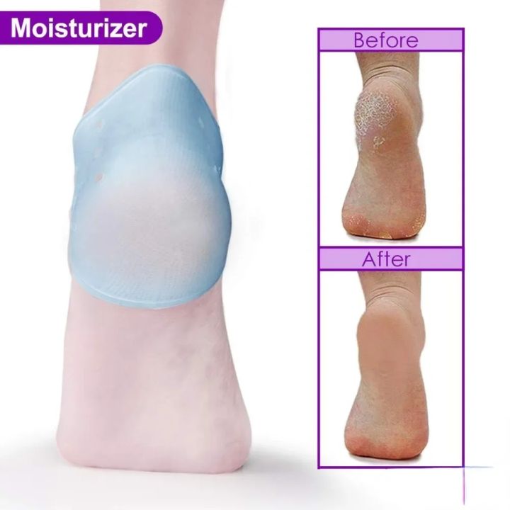 2PCS%20Heel%20Cushion%20Gel%20Heel%20Protector%20for%20Plantar%20Fasciitis%20Achilles%20Tendonitis%20Bone%20Spur%20Aching%20Feet%20Relieve%20Pain%20Pedicure%20Tools%20-%20Image%205