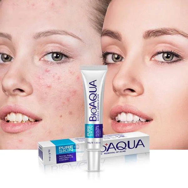 BioAqua%20Removal%20of%20Acne%20Cream%20Pimple%20Bio%20Aqu%2030g%20-%20Image%202
