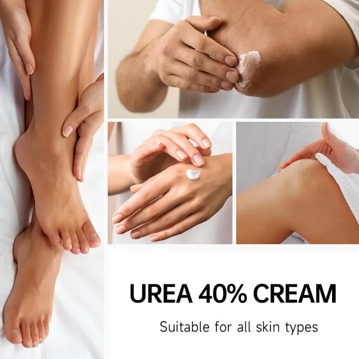Foot%20Cream%20Urea%20Cream40%25%20plus%20Salicylic%20Acid2%25%20to%20Soften%20Cracked%20Feet%20-%20Moisturizing%20Gentle%20Exfoliating%20Daily%20Foot%20Care%20Solution%20freshfeet%20-%20Image%206