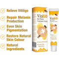 Original Vitigo Bee Venom Care Cream for Vitiligo, Pigmentation & White Spots | Skin Repair & Melanin Restoration Cream | Natural Herbal Treatment for Uneven Skin Tone | Moisturizing Anti-Spot Whitening Cream – 20g | Gadget Xpres. 