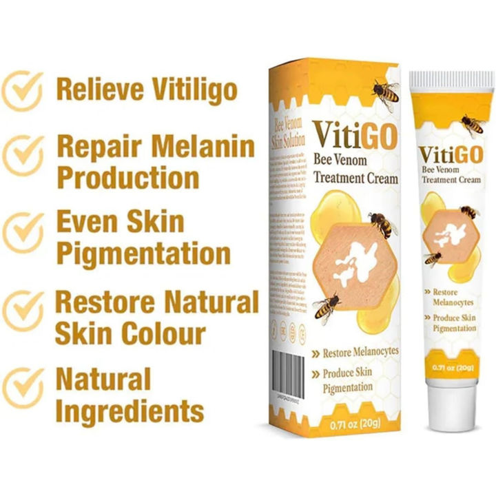 Original%20Vitigo%20Bee%20Venom%20Care%20Cream%20for%20Vitiligo,%20Pigmentation%20&%20White%20Spots%20%7C%20Skin%20Repair%20&%20Melanin%20Restoration%20Cream%20%7C%20Natural%20Herbal%20Treatment%20for%20Uneven%20Skin%20Tone%20%7C%20Moisturizing%20Anti-Spot%20Whitening%20Cream%20%E2%80%93%2020g%20%7C%20Gadget%20Xpres%20-%20Image%202