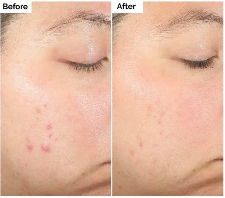 The%20Ordinary%20Salicylic%20Acid%202%25%20Solution%20%E1%80%9C%E1%80%B1%E1%80%B8%20Restock%20back%20%E1%80%95%E1%80%AB%E1%80%94%E1%80%B1%E1%80%AC%E1%80%BA%20%20%E1%80%81%E1%80%BB%E1%80%BD%E1%80%B1%E1%80%B8%E1%80%95%E1%80%B1%E1%80%AB%E1%80%80%E1%80%BA%E1%80%80%E1%80%BB%E1%80%9A%E1%80%BA/%20%E1%80%86%E1%80%AC%E1%80%B8%E1%80%9D%E1%80%80%E1%80%BA%E1%80%81%E1%80%BC%E1%80%B6/%20%E1%80%A1%E1%80%86%E1%80%AE%E1%80%96%E1%80%AF%20/%20%E1%80%A1%E1%80%99%E1%80%B2%E1%80%85%E1%80%80%E1%80%BA/%20%E1%80%A1%E1%80%99%E1%80%AC%E1%80%9B%E1%80%BD%E1%80%90%E1%80%BA%20%E1%80%90%E1%80%BD%E1%80%B1%E1%80%A1%E1%80%90%E1%80%BD%E1%80%80%E1%80%BA%20%E1%80%86%E1%80%B1%E1%80%AC%E1%80%84%E1%80%BA%E1%80%91%E1%80%AC%E1%80%B8%E1%80%9E%E1%80%84%E1%80%BA%E1%80%B7%E1%80%90%E1%80%B2%E1%80%B7%20serum%20%E1%80%9C%E1%80%B1%E1%80%B8%E1%80%95%E1%80%AB%20%20Directly%20import%20from%20USA%20%F0%9F%87%BA%F0%9F%87%B8%20%20%F0%9F%92%AF%20Authentic%20%20%20%E1%80%98%E1%80%AC%E1%80%9E%E1%80%AF%E1%80%B6%E1%80%B8%E1%80%9E%E1%80%AF%E1%80%B6%E1%80%B8%20%E1%80%86%E1%80%AC%E1%80%B8%E1%80%9D%E1%80%80%E1%80%BA%E1%80%81%E1%80%BC%E1%80%B6%20%E1%80%99%E1%80%9E%E1%80%80%E1%80%BA%E1%80%9E%E1%80%AC%E1%80%9B%E1%80%84%E1%80%BA%20%E1%80%9E%E1%80%AF%E1%80%B6%E1%80%B8%E1%80%80%E1%80%BC%E1%80%8A%E1%80%BA%E1%80%B7%E1%80%95%E1%80%AB%E1%80%9C%E1%80%AD%E1%80%AF%E1%80%B7%20%E1%80%86%E1%80%AC%E1%80%B8%E1%80%9D%E1%80%80%E1%80%BA%E1%80%81%E1%80%BC%20-%20Image%206