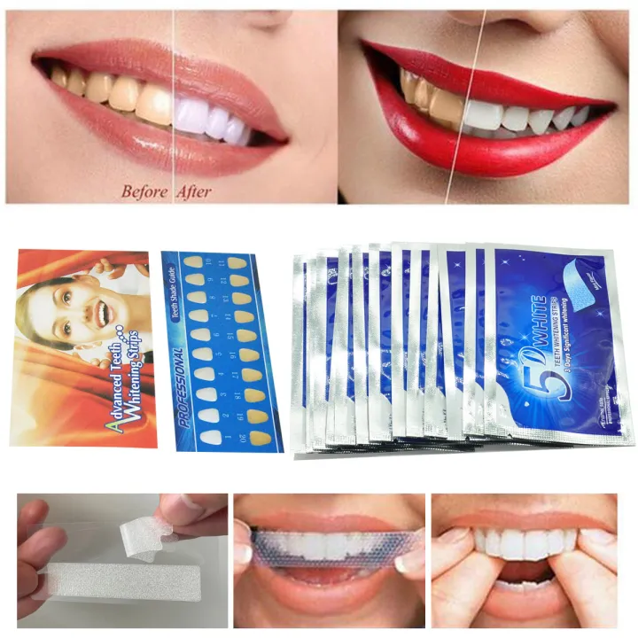 5D%20Teeth%20%20Gel%20Strips,%20Gentle%20Oral%20Care%20Brightening%20Strips,%20Home%20Dental%20Beauty%20Supplies%20for%20Teeth%20Stain%20Removal%20-%20Image%203
