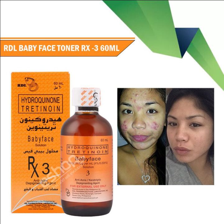 RDL Hydroquinone Tretinoin Baby Face 60ML Solution 3