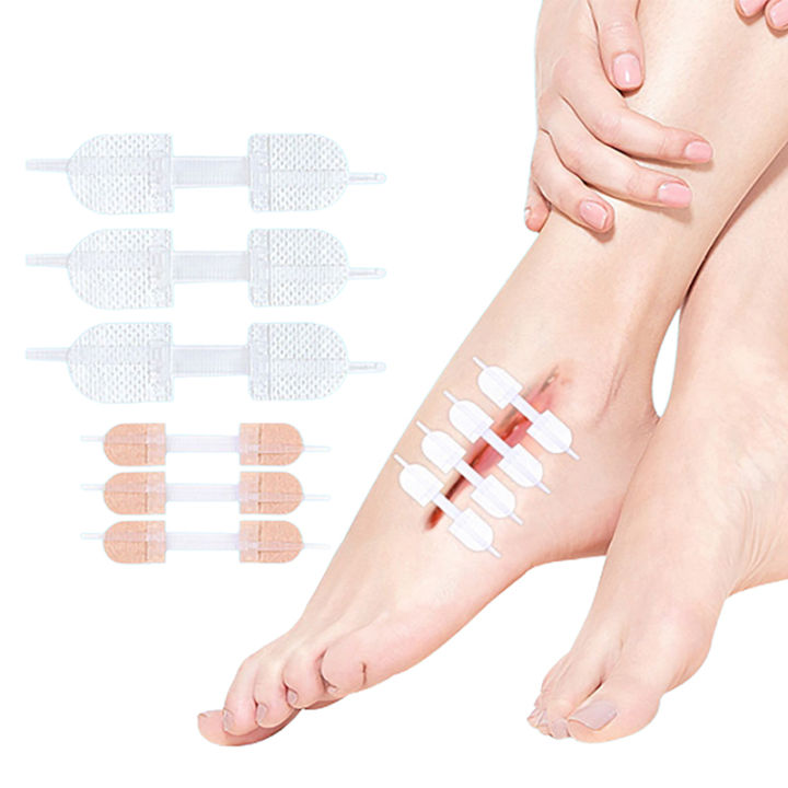 Closure Patch 3Pcs Zipper Tie Wound Closure Patch Hemostatic Patch Wound Fast Suture ...
