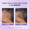 BARE ANATOMY Rosemary & Hibiscus Hair Growth Oil enriched with Bhringraj for New Hair Growth Hair Oil (100 ml). 
