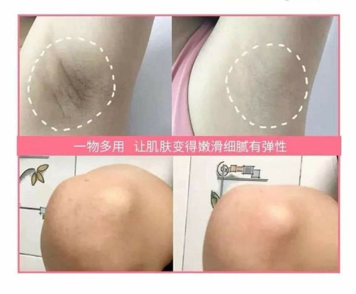 Peach%20Soap%20%E1%80%A1%E1%80%9E%E1%80%AC%E1%80%B8%E1%80%96%E1%80%BC%E1%80%B0%E1%80%86%E1%80%95%E1%80%BA%E1%80%95%E1%80%BC%E1%80%AC%20Japan%20import%20-%20Image%202