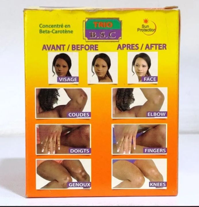 CAROTONE%20Cream%20135%20ML%20-%20Image%202