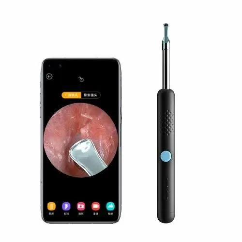 This%20Earwax%20Removal%20Camera%20Is%20Equal%20Parts%20Satisfying%20And%20Disgusting%20-%20Image%204
