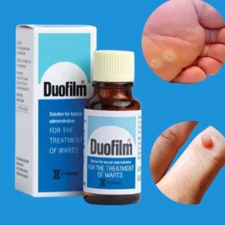 Wart%20Remover%20Doufilm%20Lotion%2015ml%20-%20Image%202