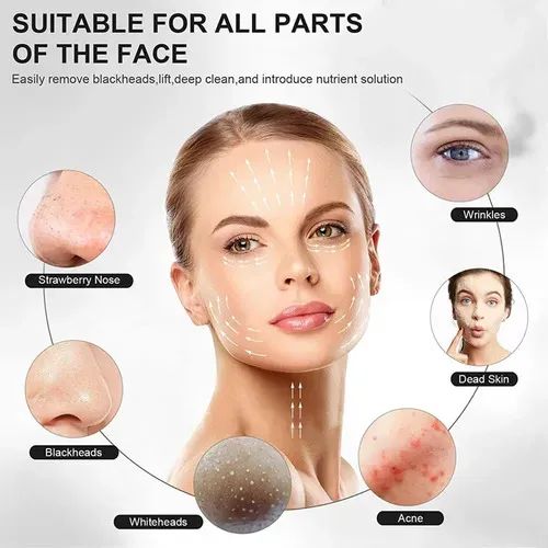 Ultrasonic%20Leather%20Shovel%20Machine%20For%20Facial%20Skin%20Scrubber%20Lifting%20Moisturizing%20&%20Cleansing%20Skin%20Dirt%20Blackhead%20Remover%20Peeling%20Tool%20-%20Image%205