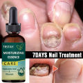 7DAYS Repair Nail Fungus Treatments Essence Foot Care Serum Toe Nails Fungal Removal Gel Anti-Infection freshfeet. 