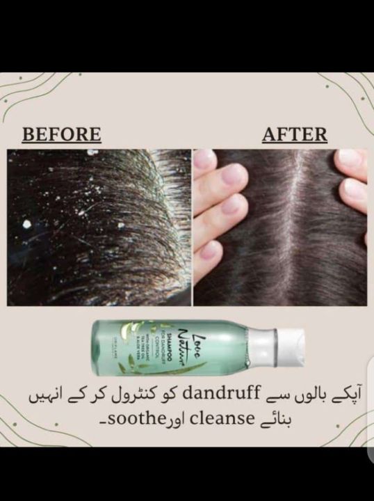 "Oriflame%20Love%20Nature%20Shampoo%20for%20Dandruff%20control%E2%80%93%20Nourish%20and%20Revitalize%20Naturally"%20-%20Image%207