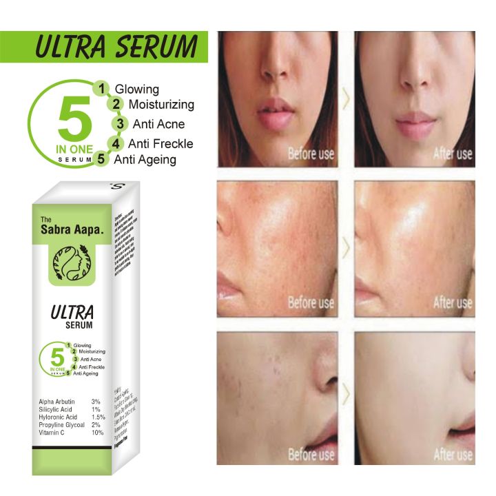 ULTRA  Skin Glowing Serum | 5% Niacinamide, 30% Vitamin C 10%, Vitamin E 10% & HA | 20 ml