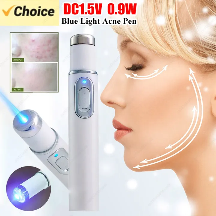 1pc%20Acne%20Wrinkle%20Removal%20Laser%20Pen%20Skin%20Spots%20Removal%20Anti%20Varicose%20Spider%20Vein%20Treatment%20Medical%20Blue%20Light%20Eye%20Massage%20Instrum%20-%20Image%202