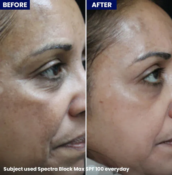 Jenpharm%20-%20Spectrablock%20Max%20SPF%20100%20Tinted%20Sunblock%2040gm%20-%20Image%204