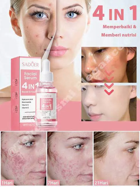 SADOER%204%20In%201%20Face%20Serum%2030ML,%20Hyaluronic%20Acid/Niacinamide/Vitamin%20C%20&%20E%20Face%20Essence%20Serum%20-%20Image%202