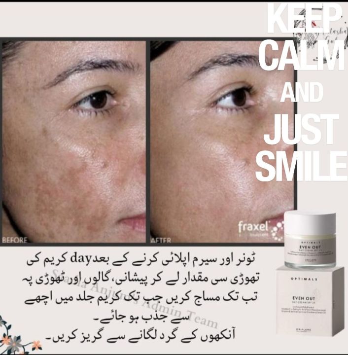 for%20frakles%20treatment,pigmentation%20,dull%20skin%20.oriflame%20products%20-%20Image%204