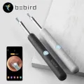 This Earwax Removal Camera Is Equal Parts Satisfying And Disgusting.