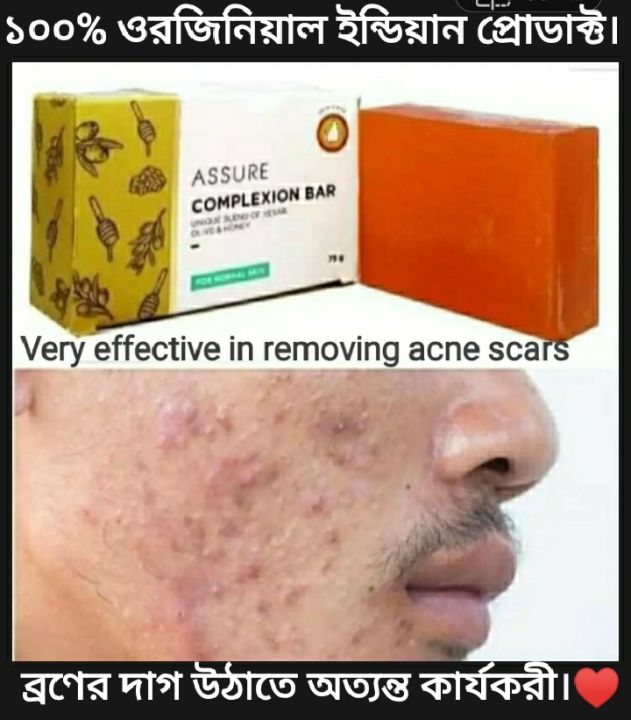 Assure%20Complexion%20%20Bar%20Soap%20Honey%20%20kesor%20&%20olive%20oil%20enriched75g%20India%20-%20Image%207