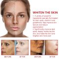 Ouhoe Dark Spot Cream 30ml. 