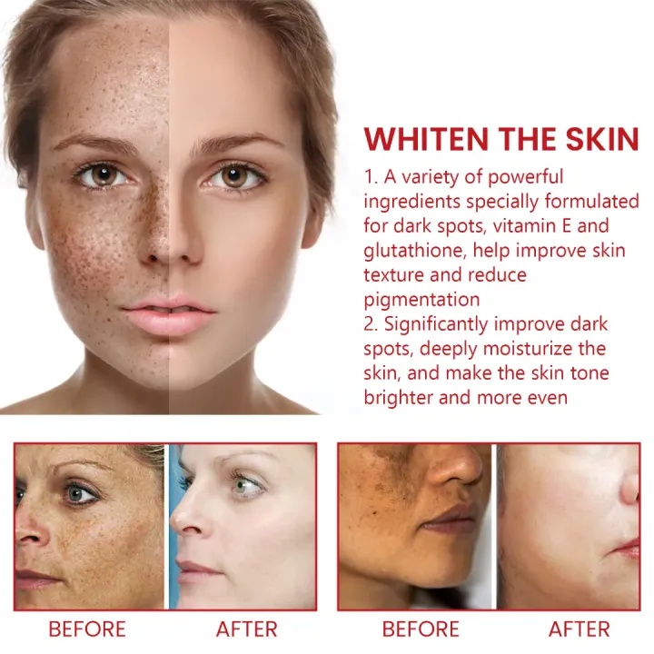 Ouhoe%20Dark%20Spot%20Cream%2030ml%20-%20Image%204