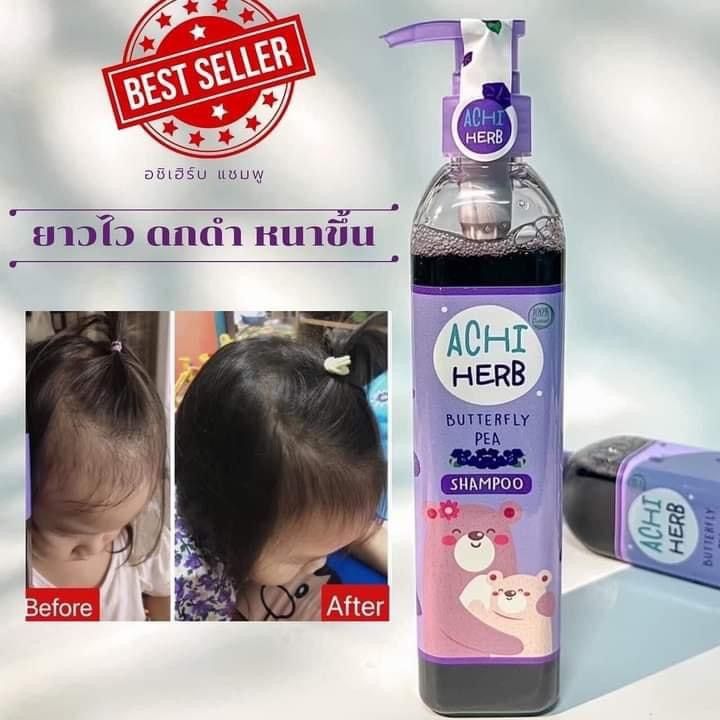 Achiherb%20Children's%20Shampoo%20Accelerates%20Hair%20Growth%20and%20Makes%20It%20Black.%20Achiherb%20Can%20Be%20Used%20by%20All%20Ages.%20Newborns%20-%20Adults%20Hair%20Loss%20after%20Giving%20Birth%20Is%20Good%20for%20Use.%20-%20Image%205