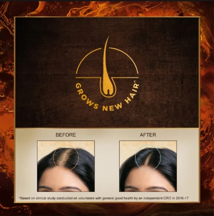 Indulekha%20Bringha%20Ayurvedic%20Hair%20Oil%20100ml%20For%20Hair%20Fall%20Control%20with%20Amla%20&%20Coconut%20Oil,%20With%20Comb%20Applicator%20-%20Image%203