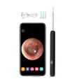 Wireless Otoscope Ear Camera 3.9mm 1296PHD WiFi Ear Scope with 6 LED Lights for Kids and Adults Support IPhone, iPad & Android.