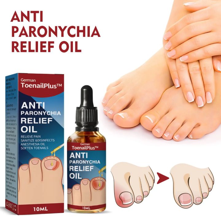 German%20ToenailPlus%E2%84%A2%20Anti%20Paronychia%20Relief%20Oil%20-%2010ML%20-%20Image%202