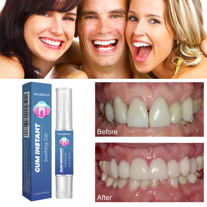 Damaged%20Gum%20Repair%20Care%20Gel%20Relieve%20Sore%20Gums%20Allergy%20Deep%20Cleaning%20Teeth%20Stains%20Tartar%20Serum%20Dental%20Caries%20Tootaste%204ml%20-%20Image%206